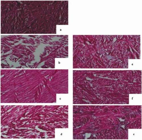 Figure 2. Histological sections of the abalone muscles by different softening treatments