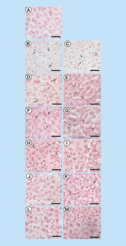 Figure 8.  Qualitative iron detection.Prussian blue assay in mouse liver of non-injected mouse (A) and after 2 h (B, C), 1 day (D, E), 7 days (F, G), 15 days (H, I), 30 days (J, K) and 60 days (L, M) of Endorem® (left panel) and bioferrofluids (right panel) injection. Black arrows are pointing ferric ions which appear as blue colored dots. Scale bar 50 μm.
