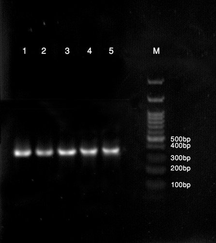 Figure 3 Agarose gel electrophoresis of the amplicon lane M: DNA marker, lane 1, positive control; (+) lane 6, negative control;(–) and lanes 2–4 visible amplification of ERG11 gene with a band size of 397 bp for Fluconazole-resistant C. albicans isolates.