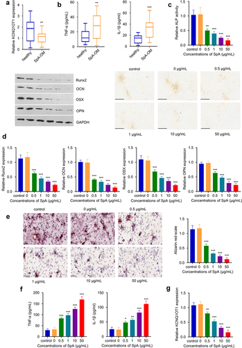 Figure 1. KCNQ1OT1 is significantly down-regulated in SpA-treated hBMSCs. (a) Expression of KCNQ1OT1 in serum samples from OM patients and healthy controls. (b) Expressions of TNF-α and IL-1β in serum samples from OM patients and healthy controls were examined by ELISA assay. (c) ALP activity in hBMSCs treated with different concentrations of SpA after osteogenic differentiation. Scale bar represents 200 μm. (d) Expression levels of osteogenic marker genes in SpA-treated hBMSCs was detected by RT-qPCR and Western blot. (e) Alizarin red S staining in hBMSCs after osteogenic differentiation under different concentrations of SpA. Scale bar represents 100 μm. (f) Expressions of TNF-α and IL-1β in SpA-treated hBMSCs after osteogenic differentiation. (g) KCNQ1OT1 level in hBMSCs treated with different concentrations of SpA after osteogenic differentiation. SpA, staphylococcus aureus; hBMSCs, human bone mesenchymal stem cells; OM, osteomyelitis. *p < 0.05; **p < 0.01; ***p < 0.001.