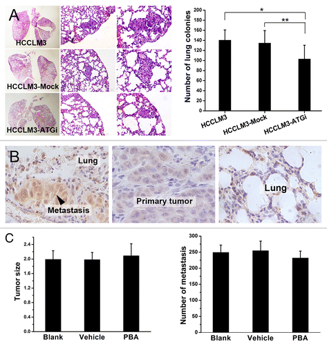 Figure 6. Autophagy inhibition suppresses lung colonization of HCC cells and ER stress is not involved in. (A) Lung colonization assays indicated that autophagy inhibition significantly suppressed lung colonization of HCCLM3 cells (*P = 0.018, **P = 0.040). (From left to right) representative panoramic image of lung section, lung metastasis (100×), and lung metastasis (200×). (B and C) ER stress was induced in metastatic colonies but the suppressive effect of autophagy inhibition on metastatic colonization was not associated with ER stress. Immunohistochemical analysis of ER stress marker HSPA5 expression in lung metastasis and paired primary tumor showed significantly higher HSPA5 expression in lung metastases, indicating that ER stress was induced in metastatic colonization (B). Further in vivo metastasis assays showed that inhibition of ER stress by PBA did not affect lung metastasis (C). The number of lung metastases of mice receiving PBA (PBA group) was not significantly different from those of mice subjected to PBA vehicle (Vehicle group) or no treatment (Blank group). (PBA vs. Blank, P = 0.247; PBA vs. Vehicle, P = 0.136).