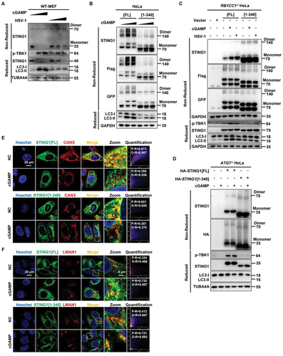 Figure 6. Translocation and dimerization of STING1 is unchanged in STING1 [1-340] which merely affected innate immune function. (A) WT MEF cells were treated with increasing amounts of cGAMP (0 µM, 1 µM, and 2 µM respectively) for 3 h or infected with increasing MOI of HSV-1-GFP virus (0, 2 and 5 respectively) for 6 h. Cell lysates were analyzed by non-reduced gel (for endogenous STING1 dimerization) or reduced gel followed by immunoblotting with the indicated antibodies. (B) WT HeLa cells stably expressing Flag- and GFP-tagged STING1 or the C-terminal truncation (STING1 [1-340]) were treated with increasing amounts of cGAMP (0 µM, 1 µM and 2 µM respectively) for 3 h. Cell lysates were analyzed by non-reduced gel (for recombinant Flag-STING1-GFP dimerization) or reduced gel followed by immunoblotting with the indicated antibodies. (C) RB1CC1-/- HeLa cells which lacking endogenous STING1 expressing were transfected with control plasmid (pcDNA3.1) or STING1 plasmids (STING1[FL] or STING1 [1-340]) for 24 h before treated with cGAMP (1 μM) for 3 h or infected with HSV-1-GFP virus at a MOI of 5 for 6 h. Cell lysates were analyzed by non-reduced gel (for recombinant Flag-STING1-GFP dimerization) or reduced gel followed by immunoblotting with the indicated antibodies. (D) ATG7-/- HeLa cells which autophagy dysfunction and lacking endogenous STING1 expressing were transfected with HA-tagged STING1 or the C-terminal truncation (STING1 [1-340]) for 24 h, cells were then treated with cGAMP (1 μM) for 3 h. Cell lysates were analyzed by non-reduced gel (for recombinant HA-STING1 dimerization) or reduced gel followed by immunoblotting with the indicated antibodies. (E-F) HeLa cells stably expressing GFP-tagged STING1 or the C-terminal truncation (STING1 [1-340]) were fixed and stained with marker antibody for ER (CANX) and the ER-Golgi intermediate compartment (LMAN1/ERGIC-53) after treated with or without 1 μM of cGAMP for 3 h, and images were then captured by confocal microscopy. All images are representative of at least three independent experiments in which > 95% of the cells displayed similar staining. Scale bar: 20 µm. The degree of colocalization for STING1 and CANX or LMAN1 was quantified by Pearson’s and overlap coefficient by Image J.