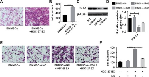 Figure 3. HGC-27-derived exosomes increase migration of BMMSCs. (A, B) The migratory ability of BMMSCs treated with or without exosomes were analyzed by transwell assay (scale bar: 500 µm). The data are expressed as means ± SD. ****P < 0.0001 by two-tailed Student’s t test. (C) PD-L1 protein levels on BMMSCs were analyzed by western blot after transfection with siRNA negative control (NC), siRNA1, siRNA2, or siRNA3. β-actin served as a loading control. (D) Quantification of PD-L1 protein changes. (E, F) The migratory ability of BMMSCs was analyzed by transwell assays. BMMSCs and siPD-L1BMMSCs treated with or without HGC-27 EX (scale bar: 500 µm). The data are expressed as means ± SD. ****P < 0.0001 by one-way ANOVA (EX: exosome; NC: negative control).