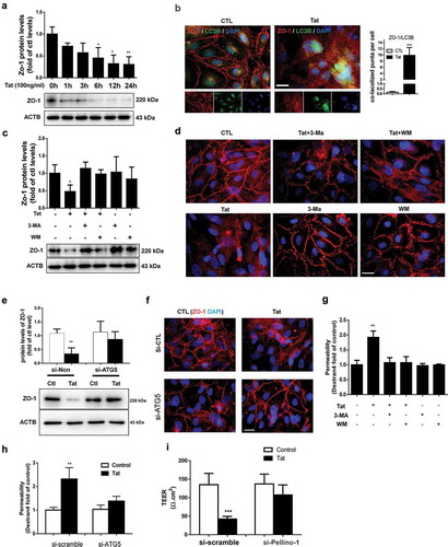 Figure 4. Role of autophagy in the Tat-mediated downregulation of tight junction protein and increased paracellular permeability in HBMECs.