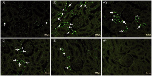Figure 3. TUNEL staining of kidney tissues are seen. (A) Group C, (B) Group D, (C) Group D + PI, (D) Group D + PII, (E) Group P and (F) Negative controls. TUNEL-positive cells (arrow) are mainly observed in the cells of distal tubules.
