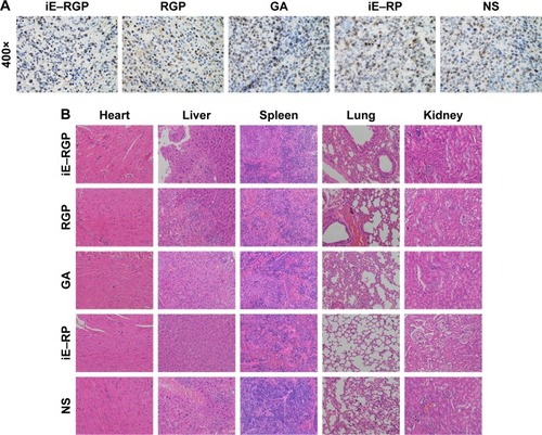 Figure 9 Antiproliferative effect and safety of iE–RBCm–GA/PLGA NPs in vivo.Notes: (A) Ki67 staining images magnification 400× of cell proliferation in tumor issues of iE–RBCm–GA/PLGA NPs (iE–RGP), RBCm–GA/PLGA NPs (RGP), free GA, iE–RBCm–PLGA NPs (iE–RP), and NS. (B) Representative H&E-stained slices image of major organs in each group (iE–RGP, RGP, GA, iE–RP, and NS).Abbreviations: GA, gambogic acid; H&E, hematoxylin and eosin; NPs, nanoparticles; NS, normal saline; PLGA, poly(lactic-co-glycolic acid); RBCm, red blood cell membrane.