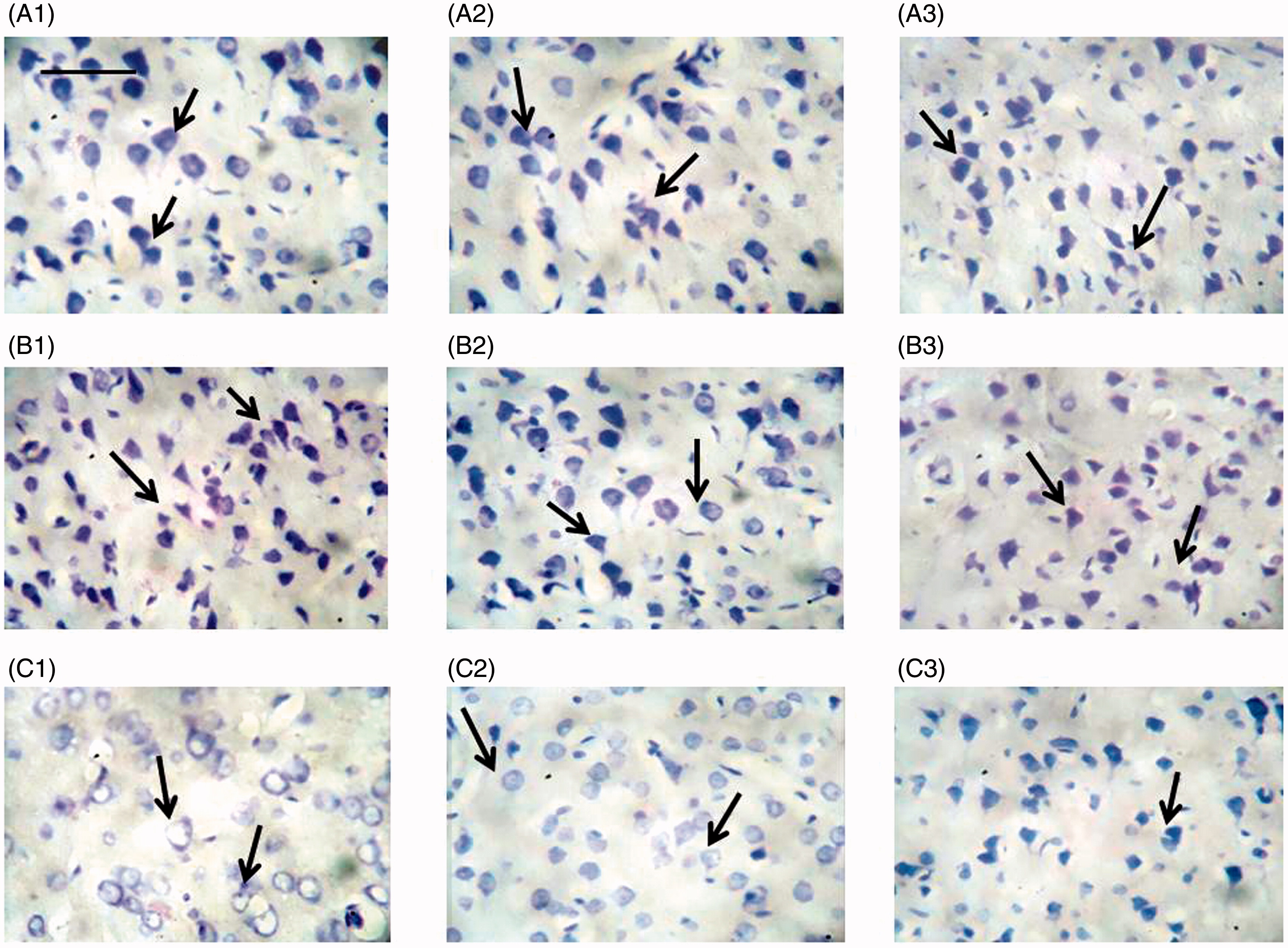 Figure 1. Nissl (cresyl violet) staining of neurons in different brain areas in rats. Representative micrographs are shown. Control rats: (A) (top row); sham-operated rats: (B) (middle row); ICIR [icv colchicine injected]: (C) (last row). Frontal cortex: 1 (left column), parietal cortex: 2 (middle column), occipital cortex: 3 (right column). Letter and number indicate group and specific brain region (e.g. A1: Frontal cortex, control rat). Magnification: 400 × , length of bar = 16.18 μm. Arrows indicate Nissl granules.