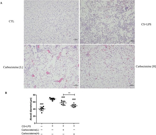 Figure 4 (A) Alveolar architecture of four groups stained with HE staining. Scale bars, 100 μm. (B) Morphometric measurements of MLI in lung tissues. Data are expressed as mean ± SD, n=8. ###P<0.001 compared to model group, **P<0.01 compared between the two carbocisteine groups (one-way Analysis of Variance (ANOVA) with Fisher’s Least Significant Difference (LSD) multiple comparisons test).