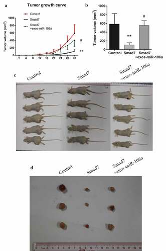 Figure 6. Exosomal miR-106a potentiates tumor growth in vivo. A. Subcutaneous xenotransplanted tumor model: the mice tumor growth curve was recorded after injection with mock-transduced BGC-823 cells, or BGC-823 cells transduced with Smad7 overexpression vector or exosomal miR-106a. B. Tumor volume of xenograft mice measured 32 days after injection. **P < 0.01, #P < 0.05. C. and D. Tumor tissues incised from the transplanted mice. Pathological studies including E. H＆E and immunohistochemical staining for detection of the tumor cells growing on the limb of nude mice and the expression of Smad7 in tumor nodules. Magnification 200 ×. F. Abdominal xenotransplanted tumor model: miR-106a antagomir and antagomir NC transfected BGC-823 cells were injected into nude mice through a small incision at cartilago ensiformis of upper abdomen. Tumor nodules on the skin, peritoneal cavity, mesenterium were shown. G. H＆E and immunohistochemical staining of the nodules on the mesenterium. Magnification 400 ×