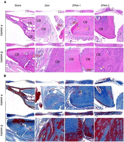 Figure 7 Histological evaluation of bone regeneration in rat calvarial defects at 4 and 8 weeks postoperatively: (A) hematoxylin and eosin staining; (B) Masson’s trichrome staining. CB indicates cortical bone, F indicates fibrous tissue, BM indicates bone marrow, Z represents the location of residual zein/ZPAA materials, and yellow arrows represent vessels (1× and 40× magnification, scale bar = 100 μm).