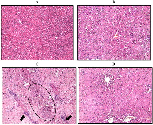 Figure 4. Representative image of hepatic sections stained with H/E. (A) Control group. (B) Control group treated with 5 mg/kg WRH-2412. (C) The liver architecture of HCC group showed massive break down of hepatic tissue together with hyperplastic nodules (Encircled) and apparent heteromorphism. (D) WRH-2412 treated rats showed greatly reduction in these histopathological features in the liver.