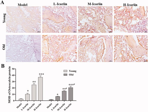 Figure 4. Icariin induces the expression of osteocalcin in the rat model of fractures. (A) Immunohistochemistry to detect the expression of osteocalcin protein. (B) The MOD of osteocalcin expression was calculated using Image-Pro Plus 6.0 software. Data are represented as the means ± SD (n = 3). *p< 0.05, **p< 0.01 and ***p< 0.001 vs. the model group. #p< 0.05 vs. the corresponding young group.