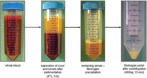 Figure 1. Fibrinogen isolation consists of three steps: separation of cruor and serum, fibrinogen precipitation, and preparation of the fibrinogen pellet by centrifugation.