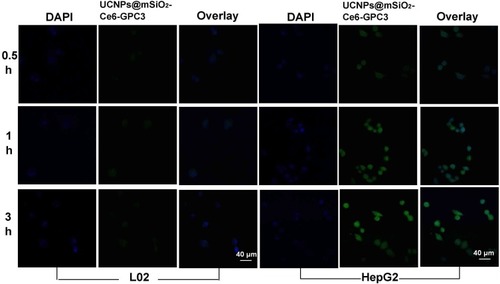 Figure 4 Confocal images of normal liver L02 cells and liver cancer HepG2 cells after co-incubation with DAPI and UCNPs@mSiO2-Ce6-GPC3. The incubation time was 0.5 h, 1 h, 3 h; The left was the DAPI staining; The middle was the UCNPs@mSiO2-Ce6-GPC3 image; The right was the overlay image of co-incubation with DAPI and the UCNPs@mSiO2-Ce6-GPC3, scale bar 40 μm.