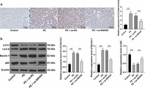 Figure 2. SNHG5 overexpression suppresses autophagy in PE mice. pCDNA3.1-SNHG5 was injected into mice via tail vein, with pCDNA3.1-NC injection as the control. (A) LC3 expression pattern was measured by immunohistochemistry. (B) levels of LC3, Beclin-1, and p62 were measured by Western blot analysis. The results were presented as mean ± standard deviation. One-way ANOVA was used to analyze the data in panels A and B. Tukey’s multiple comparisons test was applied for the post hoc test. ** p < 0.01, *** p < 0.001.