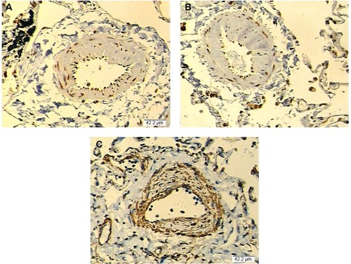 Figure 3 Comparison of the expression of COX2 (lung tissues) in each genotype group by immunohistochemistry.