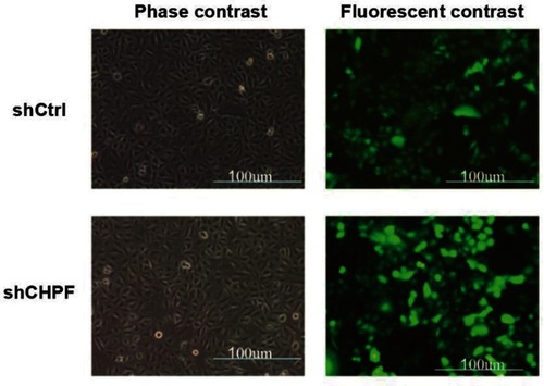 Figure 3 Observation of the transfection efficiencies using fluorescence microscopy.