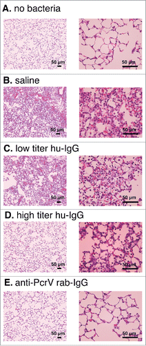 Figure 4. Lung histology 24 h after bacterial instillation. Saline, low titer hu-IgG, high titer hu-IgG, or anti-PcrV rab-IgG was administered to the mice and their lungs were removed 24 h post-instillation. A. saline solution alone (no bacteria). B. P. aeruginosa PA103 was pre-mixed with saline. C. P. aeruginosa PA103 was pre-mixed with low titer hu-IgG. D. P. aeruginosa PA103 was pre-mixed with high titer hu-IgG. E. P. aeruginosa PA103 was pre-mixed with anti-PcrV rab-IgG. Mouse lungs were fixed 10 h after bacterial instillation. Hematoxylin-eosin staining was conducted after 10% formaldehyde fixation and paraffin embedding. Magnification, 100× and 400×.