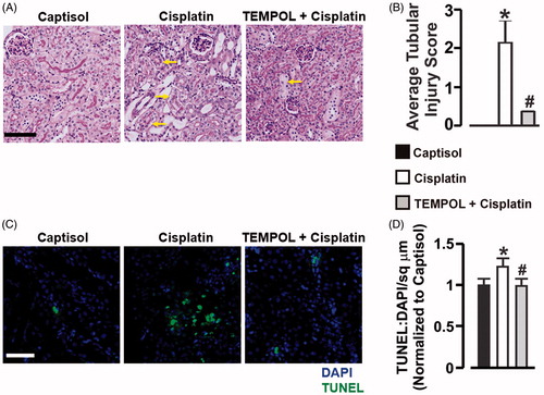 Figure 3. Cisplatin elicits ROS-dependent tubular damage and renal apoptosis in mice. (A) Images (PAS staining) and (B) average tubular injury score in Captisol (vehicle control)-, cisplatin (15 mg/kg; single IP injection)-, and TEMPOL (100 mg/kg; IP for 4 days) + cisplatin-treated mice. Cisplatin-treated groups showed variable tubular injury in the form of vacuolar degeneration and necrosis (arrows). However, TEMPOL ameliorated the severity of cisplatin-induced injury where few necrotic lesions were observed (arrow). (C) Representative confocal microscopy images, and (D) Bar graphs showing TUNEL staining and mean TUNEL positive cells/sq µm in Captisol (vehicle control)-, cisplatin (15 mg/kg; single IP injection)-, and TEMPOL (100 mg/kg; IP for 4 days) + cisplatin-treated mice. *p < .05 vs. Captisol; #p < .05 vs. cisplatin; n = 4 each. Scale bar =50 µm.