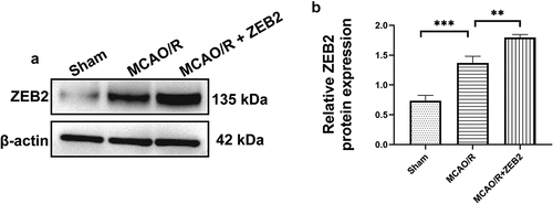 Figure 6. ZEB2 expression after AAV injection and MCAO/R model establishment. A. Western blot assay was used to evaluate the infection of AAV. B. Quantification of ZEB2 Western blot band intensity in each groups