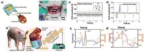 Figure 18. (a) Schematic of the biomedical application of the flexible PMN-PT energy harvester. (b) Photograph of the medical experiment on a living rat for stimulating the heart. The EGC of a living rat heart (c) before stimulation and (d) during stimulation from bending and unbending of the device [Citation283]. Conceptual scheme of (e) in vivo self-powered energy harvester attached to porcine heart. ECG showing (f) current and (g) voltage of porcine heat and energy harvesting device [Citation286]. (Reproduced from Ref [283] and [286] with permissions of John Wiley and Sons (Copyright 2014 and 2017) respectively).