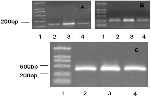 Figure 3. RT-PCR analysis of mdr1 and HSP70 mRNA expression. (A) mdr1 gene expression; (B) HSP70 gene expression; (C) GAPDH gene expression (Lane 1, DNA maker; Lane 2, control; Lane 3, HT; Lane 4, Que + HT).