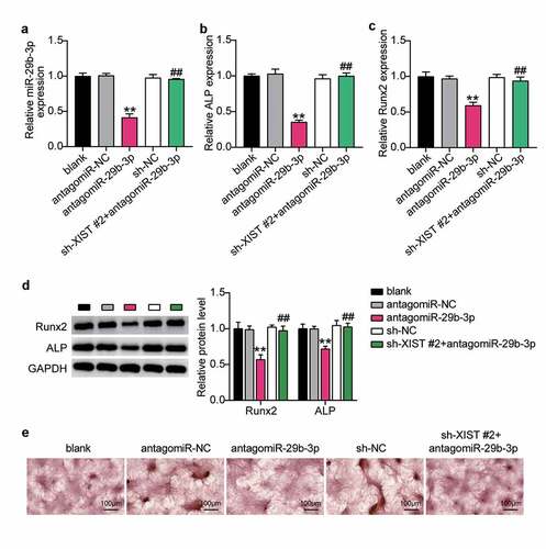 Figure 5. XIST inhibits osteogenic differentiation by inhibiting miR-29b-3p.(a) The expression of miR-29b-3p in BMSCs after transfection of antagomiR miR-29b-3p or sh-XIST 2#. (b) The expression of ALP mRNA in BMSCs after transfection of antagomiR miR-29b-3p or sh-XIST 2#. (c) The expression of RUNX2 mRNA in BMSCs after transfection of antagomiR miR-29b-3p or sh-XIST 2#. (d) The expression of RUNX2 and ALP protein in BMSCs after transfection of antagomiR miR-29b-3p or sh-XIST 2#. (e) Calcium deposition in BMSCs transfected with antagomiR miR-29b-3p or sh-XIST 2# was detected by ARS staining