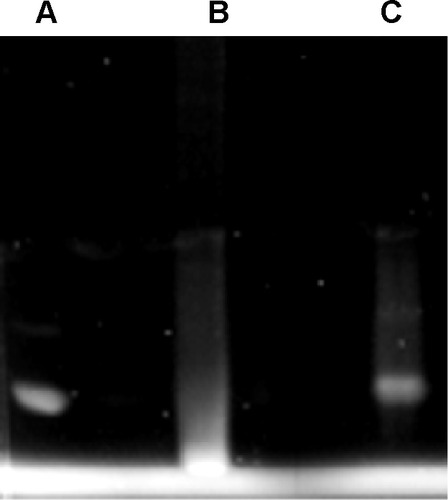 Figure 2 PAGE electrophoresis under a UV transilluminator.Notes: Samples: (A) anti-A; (B) QDs with coupling agents (negative control, bare QDs); and (C) QDs-anti-A.Abbreviations: PAGE, polyacrylamide gel electrophoresis; QDs, quantum dots; UV, ultraviolet.