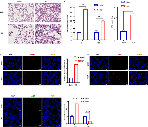 Figure 1 Macrophages Were Activated in the Lung Tissues of ALI Mice. (A) Histopathological analysis of lung tissues. After CLP modeling for 24 hours, H&E staining was used to evaluate the degree of lung inflammation in mice (n=6 per group), The images taken at 200X magnification correspond to a scale of 100 μm, while the images captured at 400X magnification correspond to a scale of 50 μm. (B) The pro-inflammatory cytokines IL-6 and TNF-α were detected by qPCR (n = 6 per group).The infiltration of inflammatory cells in lung tissue was measured by MPO activity (n=6 per group),**p<0.01, ***p<0.001. (C) After sectioning, the number of macrophages in lung tissue was detected by anti-CD68 antibody staining (n=6 per group). Intensity of immunofluorescence in lung tissues of CD68. (D)Intensity of immunofluorescence in lung tissues of M1 macrophages, (n =6 per group). iNOS (M1, green). Intensity of immunofluorescence in lung tissues of M2 macrophages, (n =6 per group). Arg1 (M2, red).