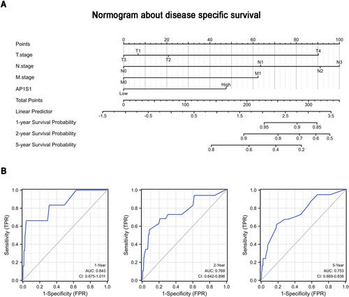 Figure 6 A nomogram about disease specific survival. (A) A nomogram for predicting the 1 year, 2 years, and 5 years disease specific survival probability of breast cancer patients. (B) ROC curves of the nomogram.