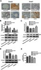 Figure 4 Effect of XJXBCQ on TGF-β1 and p-Smad2 phosphorylation. (A) Immunohistochemical and Western blotting assays were conducted to detect the expression levels of Smad2, p-Smad2, Smad7 and TGF-βRII in different lung tissue groups. Scale bar, 100 μm. (B–D) Western blot with an antibody to GAPDH/β-actin was used to ensure equal loading of proteins in each lane. The blots were photographed and quantified for each sample. The data shown were obtained from three independent experiments. (E) The expression levels of TGF-β1 in the serum of rats were detected by ELISA. Each value is presented as the mean±SD of the three independent experiments. **P<0.01 ##P<0.01 versus the model group.