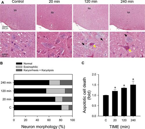 Figure 8 Cadmium induces necrotic and apoptotic cell death in RVLM. (A) Representative photomicrographs of RVLM stained by hematoxylin and eosin showing nuclear karyolysis and eosinophilic neurons in rats 20, 120 or 240 min after receiving cadmium (Cd; 4 mg/kg, i.v.), or their sham-controls. (B) Stacked bar plots showing the average distribution of neurons in RVLM (in percentage) based on morphology from hematoxylin and eosin staining. These results are typical of 3 animals from each experimental group. In (A), NA, nucleus ambiguous; yellow arrow, eosinophilic neuron; black arrow, neuron exhibiting karyolysis. (C) changes in apoptotic cell death against sham-controls in tissues collected from RVLM of rats that received 20, 120 or 240 min after cadmium. Values are mean ± SEM, n = 4 animals per experimental group. *P < 0.05 vs sham-control (C) group in the Dunnett multiple-range test.