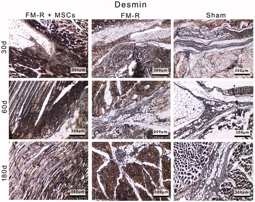Figure 8. Representative anti-Desmin-stained sections of the muscle explants retrieved from subjects with VML injury at 30, 60 and 180 days post-transplantation. Scale bars: 300 µm.