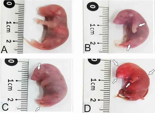 Figure 2. Photographs of mice fetuses on gestation day 18.5 showing external morphology. (a) normal fetus with correct shape and length from control group. (b), (c) and (d) the feuses from RA treated group showing some malformations as curved body, small head size, fore-and hind-limbs defects, opened eye, short tail and syndactyly.