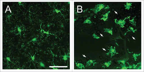 Figure 1. States of existence of microglia. (A) Naive microglia in the neocortical region of CX3CR1-GFP mice exhibits delicate, branched processes oriented radially to a small elliptical soma. (B) Interactions of microglia with Cryptococcus neoformans strain H99 in a brain lesion of a CX3CR1-GFP mouse intratracheally infected for 14 days. Microglia became reactive or amoeboid or phagocytic-like in shape upon interaction with yeast cells (white arrows). During this phase, there is hypertrophy of the soma including shortened and fewer processes. Scale bar: 50 µm.