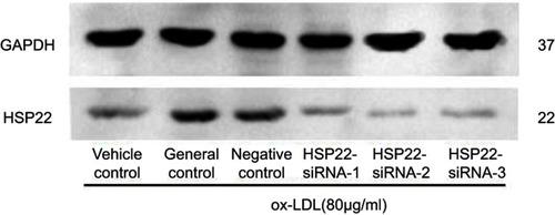 Figure S1 Representative image of HSP22 suppression by siRNA. HCAECs were transfected with HSP22-siRNA or non-specific siRNA as described in the Materials and methods section. Level of HSP22 was examined by immunoblotting as described in the Materials and methods section.