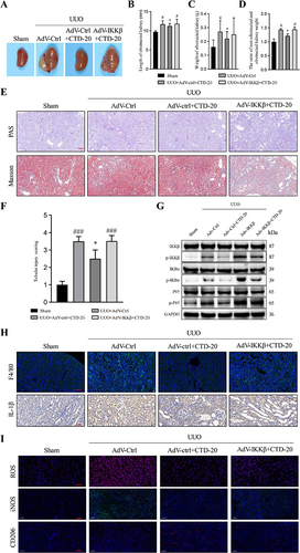 Figure 8 IKKβ overexpression partially attenuated the inhibitory effect of CTD on renal fibrosis in vivo. (A) Representative pictures of kidney of mice, (B) kidney length, (C) kidney weight, (D) the ratio of kidney weight to contralateral non-obstructed kidney weight of mice, (E) PAS and Masson staining of histological structure of kidney (×200 magnification), (F) tubular injury score of experimental mice, (G) Masson staining of kidneys in each group, (G) Western blot analysis of p-IKKβ, IKKβ, IκBα, p-IκBα, p-P65 and P65 in different groups, (H) immunofluorescence staining and IHC of F4/80 and IL-1β expression in kidneys. (I) representative pictures of ROS, iNOS, and CD206 staining of kidneys from different group. # P < 0.05, ### P < 0.001, compared to the sham group; *P < 0.05, compared to the UUO+AdV-ctrl+CTD-20 group, (n = 5 mice each group).