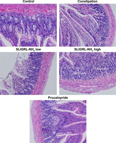 Figure 2 Histological features of colons of rats in different groups with H&E staining.