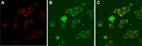 Figure 4 Internalization of CNPs.Notes: (A) Red fluorescence from LysoTracker® Red showing lysosomes and acidic vesicles; (B) green fluorescence from curcumin showing intracellular localization of CNPs; (C) overlap image of both figures (A and B) resulted in yellow spots showing that CNPs are in the lysosomes, and acidic vesicles of mature endosomes.Abbreviation: CNPs, curcumin-loaded poly(lactide-co-glycolide) nanoparticles.