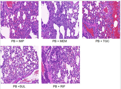 Figure 3 Pulmonary histopathology of PB combined group after 48 hours of treatment (hematoxylin-eosin staining, ×200).
