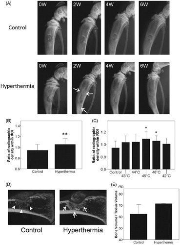 Figure 2. Radiographic evaluation for targeted hyperthermia. (A) Temporal change in radiographs of the right tibia in the control and hyperthermia groups (representative images of 43–46 °C) at baseline (0W), 2 weeks (2W), 4 weeks (4W), and 6 weeks (6W) after implantation. Hyperthermia was applied at the time of implantation (once, for 15 min). At 2 weeks, the radiodensity around the tibial defect in the hyperthermia group (arrows) was increased compared with that in the control group. (B) Changes in the radiodensity of right tibias from baseline to 2 weeks after implantation were plotted on a graph in the control (n = 8) and hyperthermia groups (n = 32). The radiodensity of right tibias at two time points (0 and 2 weeks) was normalised with reference to that of left tibias. (C) Changes in radiodensity in each hyperthermia group (43–46 °C, n = 8 each) and 42 °C (n = 5) from baseline to 2 weeks after implantation were plotted on a graph. The radiodensity in groups treated at 45 °C and 46 °C was significantly increased compared with the control group. Data are expressed as the mean ± SD. *p < 0.05 compared with control group. **p < 0.01 compared with control group. (D) Representative sagittal images of the right tibia with µ-CT in the control and hyperthermia groups (45 °C) at 2 weeks after implantation. Consolidation around the tibial defect in the hyperthermia group (arrows) was increased compared with that in the control group (arrowheads). (E) The bone volume/tissue volume (BV/TV) around the tibial defect at 2 weeks after implantation was plotted on a graph for the control (n = 2) and hyperthermia groups (45 °C and 46 °C, n = 2). The BV/TV around the tibial defect was greater in the hyperthermia group than in the control group. Data are expressed as the mean ± SD.