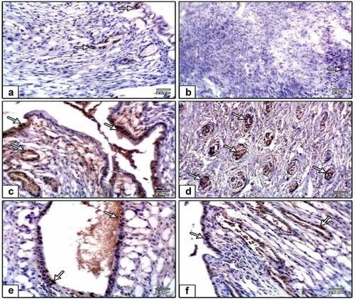 Figure 11. Photomicrographs of formalin-fixed rat uterine immunohistochemical stain with ki-67 (a), negative control (b), PVP-capped AuNRs positive control (c and d) and DMBA carcinogenesis (e and f). DMBA carcinogenesis treated with PVP-capped AuNRs. Note that increased immunostaining of ki-67 in DMBA carcinogenesis and improved in PVP-capped AuNRs-treated studied groups the degree of ki-67 immunoreactivity is shown by the arrowheads.