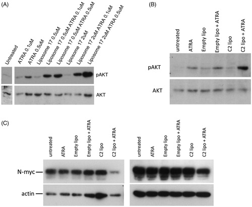 Figure 5. (A) SK-N-SH cells were treated for 72 h with ATRA, C17 liposomes (C17 lipo), or combinations. Immunoblotting shows levels of pAKT and AKT; the untreated lane is from the same blot. (B) A second experiment is shown in which SK-N-SH was treated with ATRA alone, or in combinations with empty liposomes or C2 liposomes (C2 lipo). Immunoblotting of pAKT and AKT is shown. (C) LAN5 cells were treated for 24 h with 0.1 µM ATRA alone and in combinations with empty liposomes and C2-containing liposomes. Immunoblotting shows levels of N-myc and actin. Two independent experiments are shown and maximal, hypothetical concentrations of the RAMBAs are indicated.