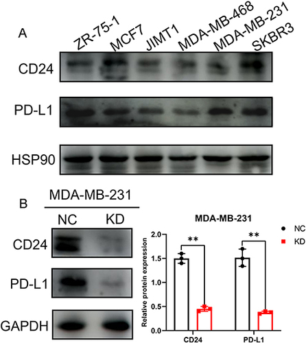 Figure 6 CD24 can directly regulate the expression of PD-L1 in MDAMB-231 TNBC cell. (A) The expression of CD24 and PD-L1 in six kinds of breast cancer cell lines. (B) The expression of CD24 and PD-L1 in MDA-MB-231 TNBC cells after the silence of CD24 expression (**P<0.01).