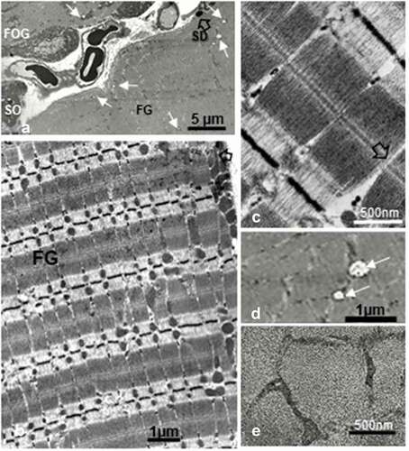 Figure 12. a-e: Obese female Zucker fast glycolytic (FG) muscle fiber ultrastructural aspects in cross, oblique and longitudinal sections. Typical myofibril architecture also showed throughout mitochondrial degradations as mitolyses or mitoptoses (small white arrows) and enlarged in d. These degradations occurred mostly within outermost regions of the myocytes. Notice throughout all the sections no glycogen aggregates (as in c, black arrows) showed in the intermyofibrillar sarcoplasm