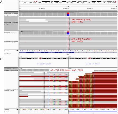 Figure 2 NGS analysis of the lung metastasis and plasma samples. (A) Missense mutation of AKT1 p.E17K in lung tissue and plasma samples. (B) The deletion mutation (c*612-2173+34del) of exons 5–7 and a part of exon 8 of AR in lung tissue.