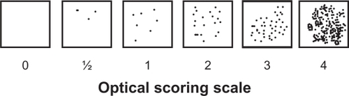 Figure 1 An example of the standard quantal visual scale method for grading immunostained cells, as used for this study.