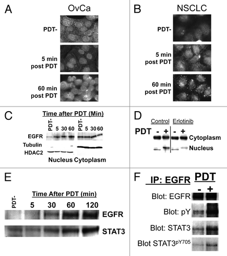 Figure 2. BPD-mediated PDT stimulated nuclear co-localization of EGFR-STAT3. (A) OVCAR-5 (OvCa)or (B) H460 (NSCLC) cells were incubated with BPD as in Figure 1. Prior to light exposure (PDT-) or the indicated time after delivery of 0.5 J/cm2 at 30 mW/cm2 690 nm light, cells were fixed/permeabilized in 4%paraformaldehyde, 0.1% triton (added to permeablize the nucleus for staining). EGFR was visualized using a poly-clonal anti-EGFR antibody and fluorescent immunocytochemistry secondary antibodies. (C) OVCAR-5 cells treated as above and fractionated into nuclear and cytoplasmic fractions using a hypotonic, non-denaturing lysis buffer and passage through a 28Ga syringe. After greater than 95% lysis of cells and retention of unlysed nuclei were verified using light microscopy, nuclei were recovered by centrifugation and the supernatant fraction was retained. Proteins were solubilized in both fractions using a denaturing, reducing buffer and resolved by SDS PAGE. Western blotting was performed using the indicated antibody. Tubulin and HDAC2 were used as a marker to confirm the cytoplasmic and nuclear fractions, respectively. (D) OVCAR-5 cells were treated as in C) following overnight pre-treatment with 4µM erlotinib or carrier (DMSO) and western blotting was used to detect EGFR in nuclear vs cytoplasmic fractions. (E) OVCAR-5 cells were treated as in C) and nuclear fractions were analyzed for EGFR or STAT3 by western blotting. (F) OVCAR-5 cells were treated as in Figure 1B and EGFR was immunoprecipitated. Resultant immune complexes were washed extensively to remove non-specifically adherent proteins, resolved by SDS-PAGE under denaturing conditions and western blot analysis was performed using the indicated antibody. All results in this figure are representative of experiments performed in triplicate.