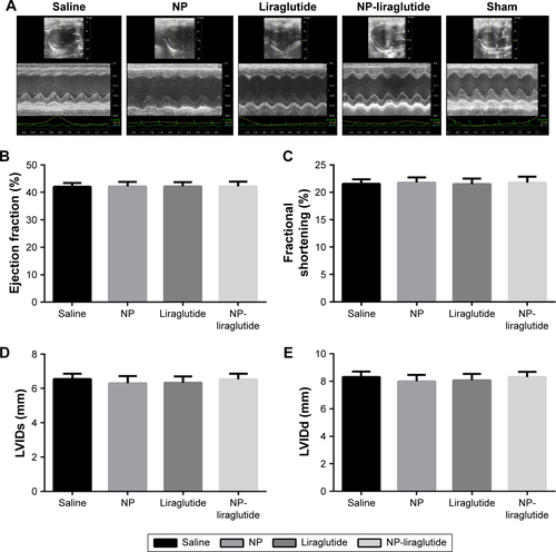 Figure S1 Echocardiographic assessments.Notes: (A) Representative echocardiographic images from each group 2 days after ligation. The LVEF (B), LVFS (C), LVIDs (D) and LVIDd (E) were assessed via two-dimensional echocardiography. The change in each measurement is summarized. Data are shown as mean ± SEM. NP-liraglutide: liraglutide loaded in PLGA–PEG NPs.Abbreviations: LVEF, left ventricular ejection fraction; LVFS, left ventricular fractional shortening; LVIDs, left ventricular internal systolic dimension; LVIDd, left ventricular internal diastolic dimension; NP, nanoparticle; PEG, poly(ethylene glycol); PLGA, poly(lactic-co-glycolic acid); SEM, standard error of the mean.