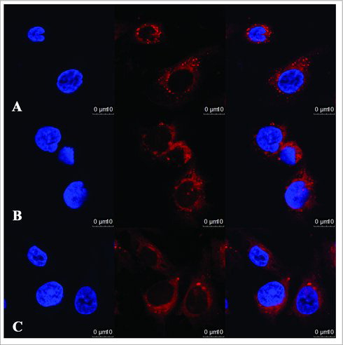 Figure 3. Localization of circRNAs in AGS human GC cell line. RNA fluorescence in situ hybridization for circRNAs. Nuclei were stained with 4,6-diamidino-2-phenylindole (DAPI). Scale bar, 10 μm. (A) circRNA0047905; (B) circRNA0138960; (C) circRNA7690-15.